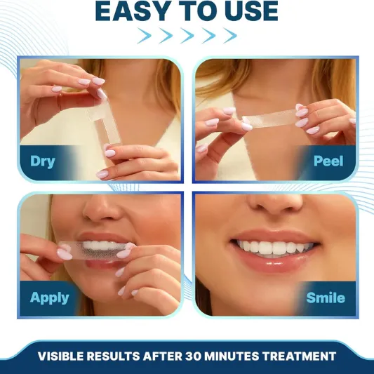 IvorySmile Teeth Whitening Strips Review 6 ivorysmile teeth whitening strips review3