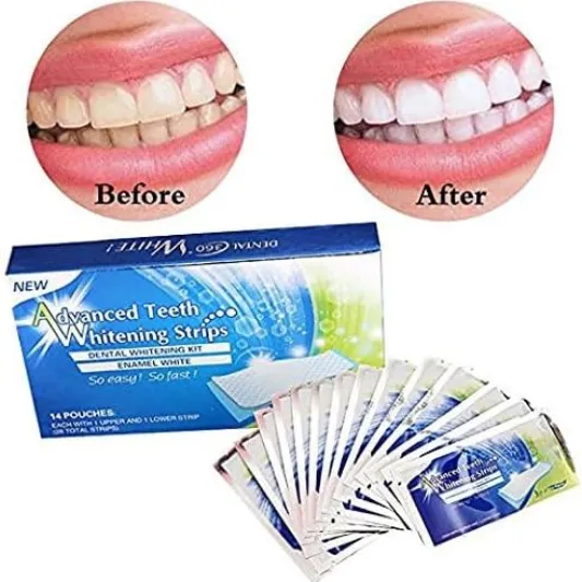 Kav Plus Teeth Whitening Strips Review 5 kav plus teeth whitening strips review2