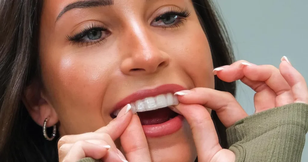 Whites Beaconsfield Teeth Whitening Strips Review