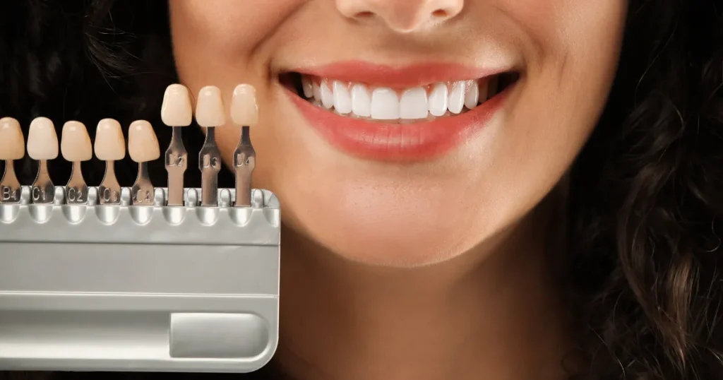How Often Can You Use Crest Teeth Whitening Strips?